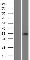 ZNF75A (NM_153028) Human Tagged ORF Clone