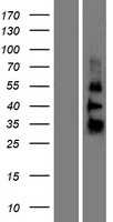 ZGLP1 (NM_001103167) Human Tagged ORF Clone