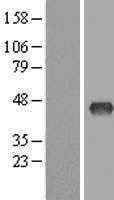ZDHHC2 (NM_016353) Human Tagged ORF Clone