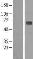 ZNF179(RNF112) (NM_007148) Human Tagged ORF Clone