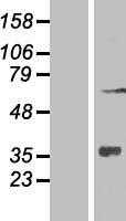 ZNF286(ZNF286A) (NM_001130842) Human Tagged ORF Clone