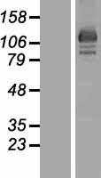 OSBP2 (NM_030758) Human Tagged ORF Clone