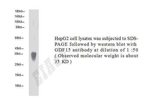Human GDF15 Polyclonal Antibody
