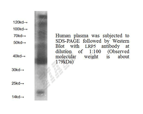 Human LRP5 Polyclonal Antibody