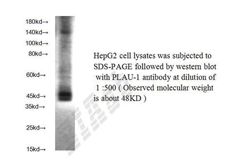 Human PLAU Polyclonal Antibody