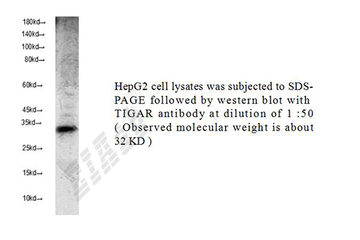 Human TIGAR Polyclonal Antibody