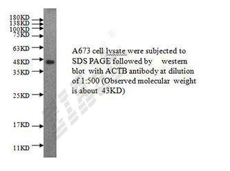 Human ACTB Polyclonal Antibody