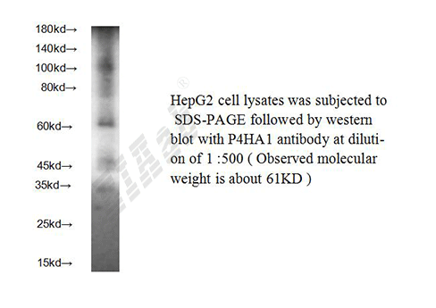 Human P4HA1 Polyclonal Antibody