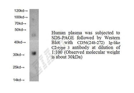 Human NCAM1 Polyclonal Antibody