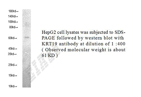 Human KRT19 Polyclonal Antibody