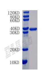 Human RNLS Protein