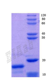 Human HMGB1 Protein