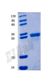 Human FNDC5 Protein