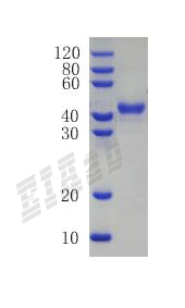 Human REG4 Protein