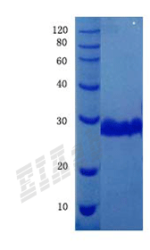Human GPNMB Protein