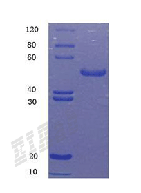 Human PLD3 Protein