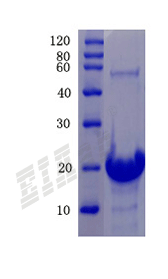 Human PARM1 Protein