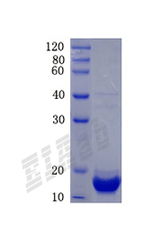 Human S100A2 Protein