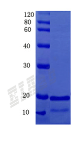 Human RPE65 Protein