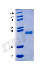Human DUSP1 Protein