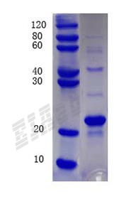 Human P4HA1 Protein