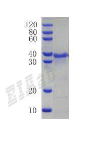 Human TIMP1 Protein