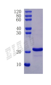 Human FABP2 Protein