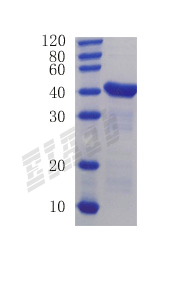 Human LRPPRC Protein