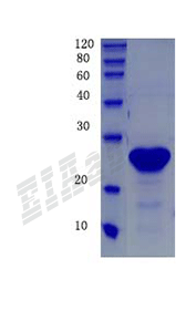 Human SOD1 Protein