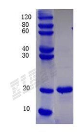 Human TNFSF11 Protein