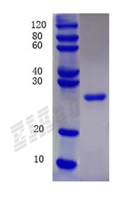 Human GPC3 Protein