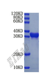 Human PDCD1 Protein