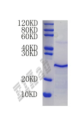 Mouse Timp1 Protein