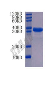 Human HMGB2 Protein