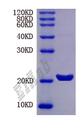 Human PFKFB4 Protein
