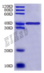Mouse Thbs1 Protein
