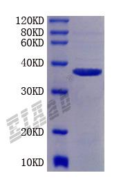 Human GSK3B Protein
