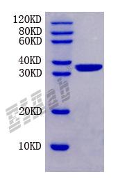 Mouse Abcb1 Protein