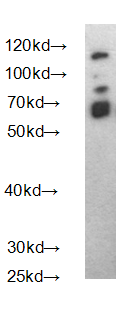 Human H3F3A Polyclonal Antibody