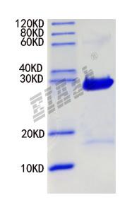 Rat Fcer1a Protein