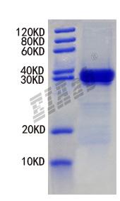 Human PKD2 Protein