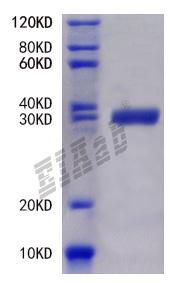 Human SCGB2A1 Protein