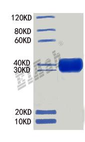 Human STAB1 Protein