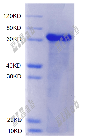 Human MAGED1 Protein