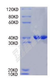 Human SPHK2 Protein
