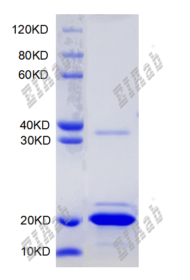 Mouse Wnt5a Protein