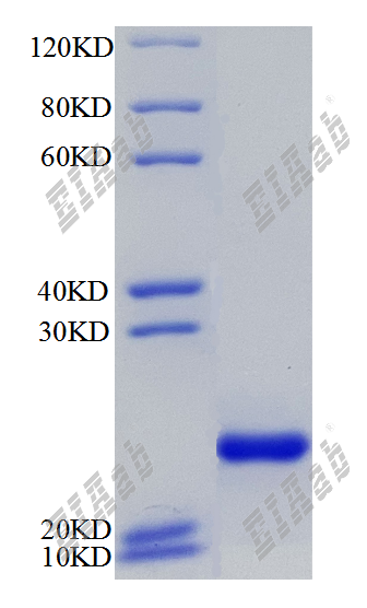 Mouse Lgr5 Protein