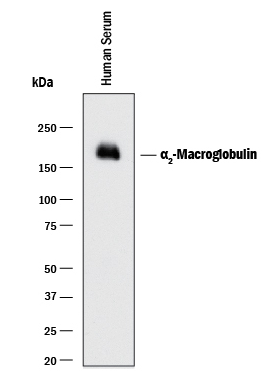 Human A2M Monoclonal Antibody