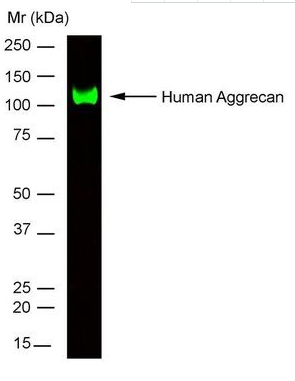Human ACAN Monoclonal Antibody