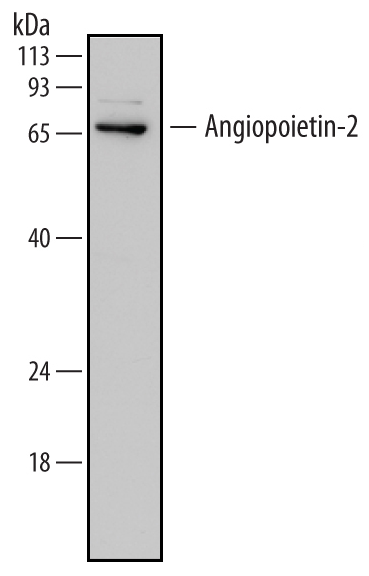 Human ANGPT2 Monoclonal Antibody